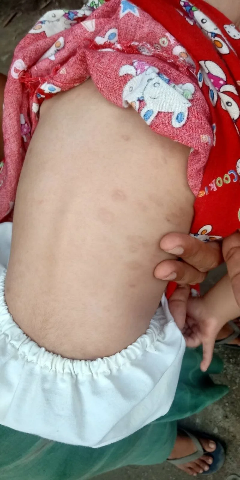 Access to a doctor in the Sagaing Hills