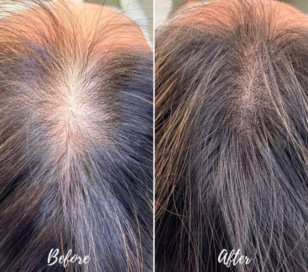 Scalp_B&A_AANYC