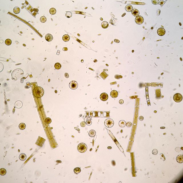 Wondering who lives inside all those brown layers in the ice we study? A whole lot of microorganisms of many shapes, sizes, and classes! Looking at our samples under the microscope gives us a quick look at what kind of organisms are around and who is