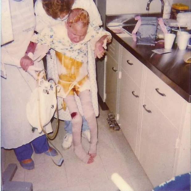 First time out of bed. June 8th 1988. My physical therapist Pam holding me up.