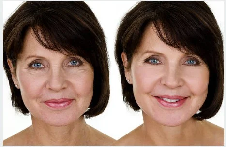 beforeafter.jpg