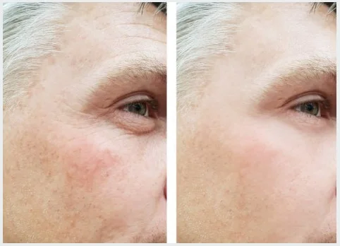 man beforeafter.jpg