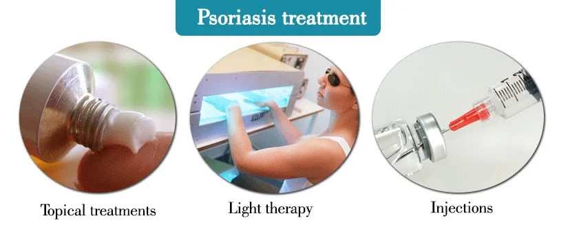 psoriasis 4.jpg