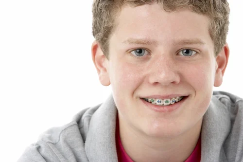 braces-maple-grove.jpg