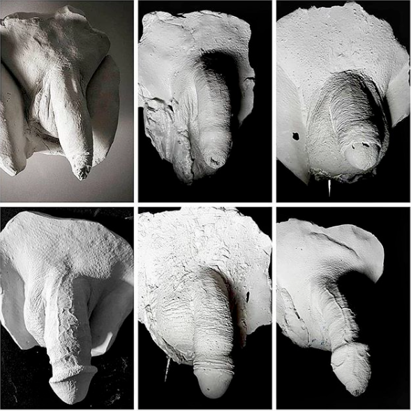 Not All Penises Look the Same and That's OK!
