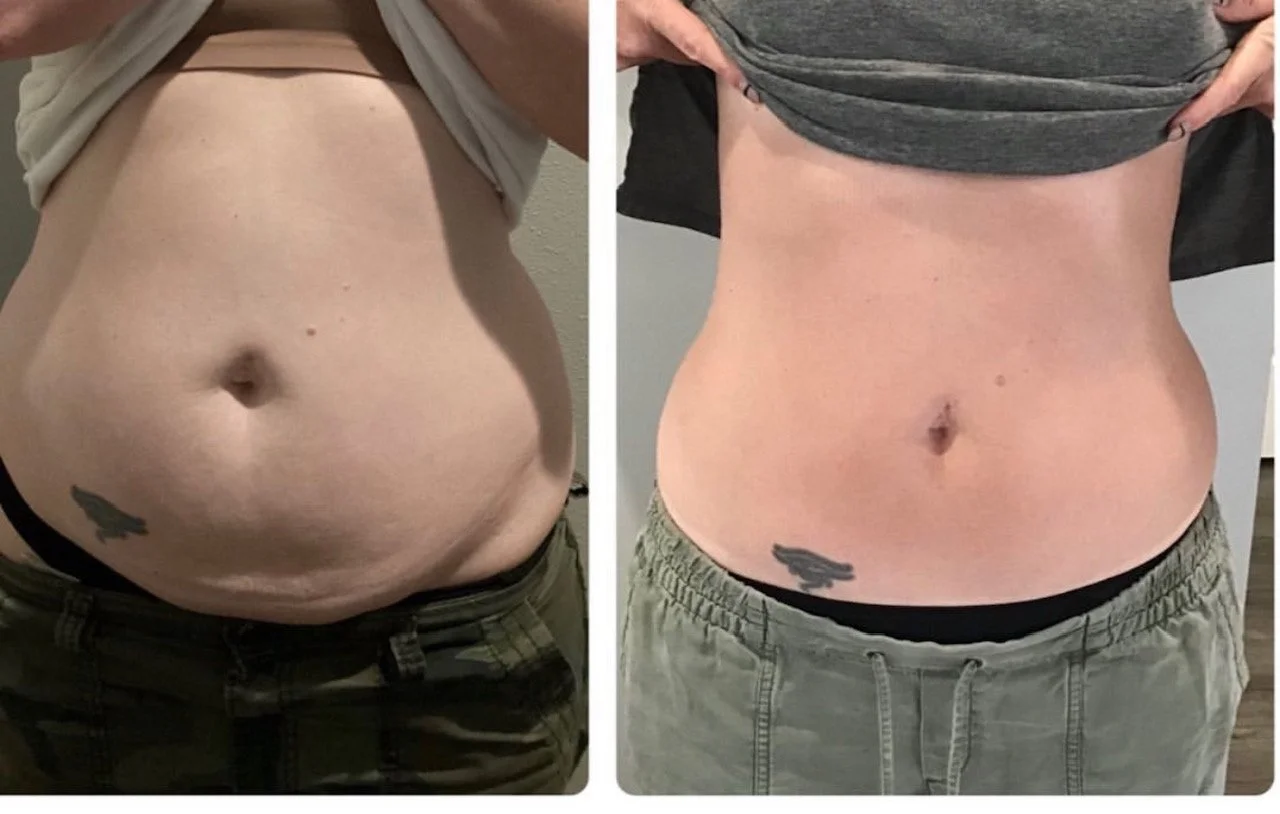 Before and Afters — The Sculpt Pod