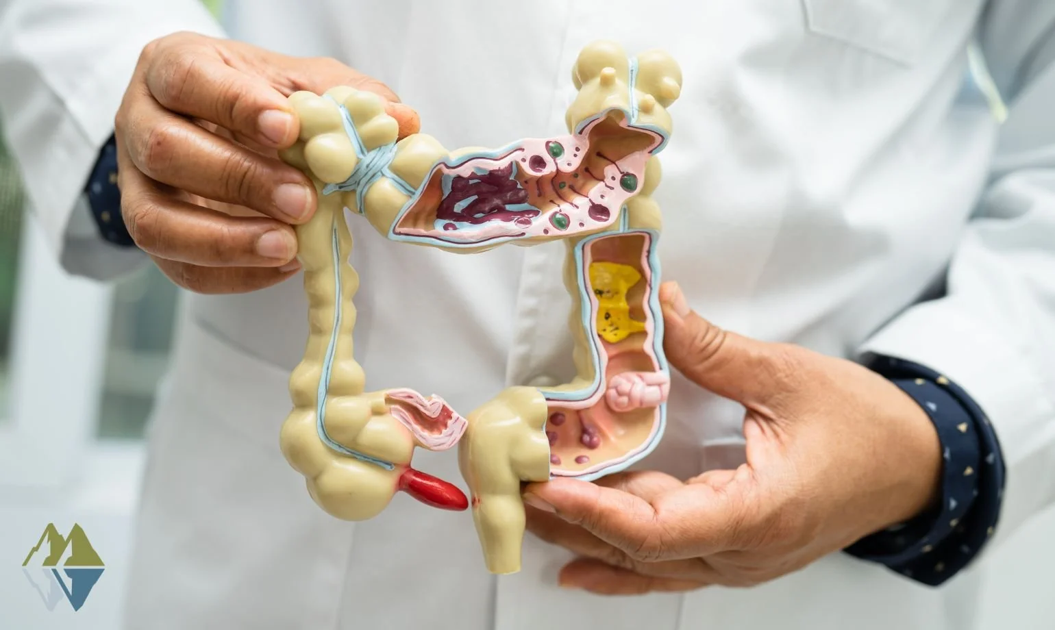 Gut Health: Why does it Matter?