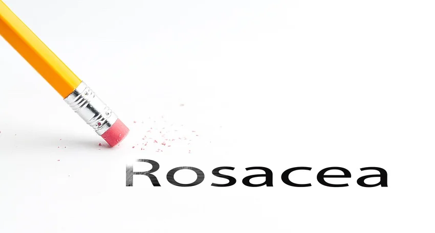 Beauty Clinic: Cruelty-free rosacea care