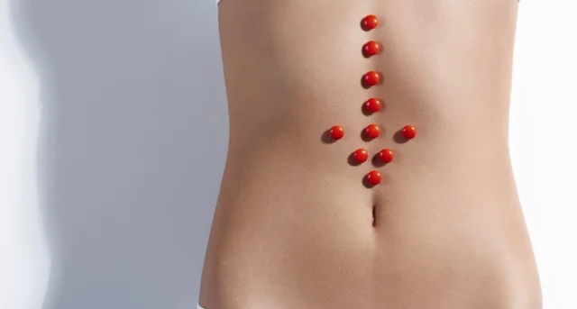 What's best for the Helicobacter pylori stomach infection?