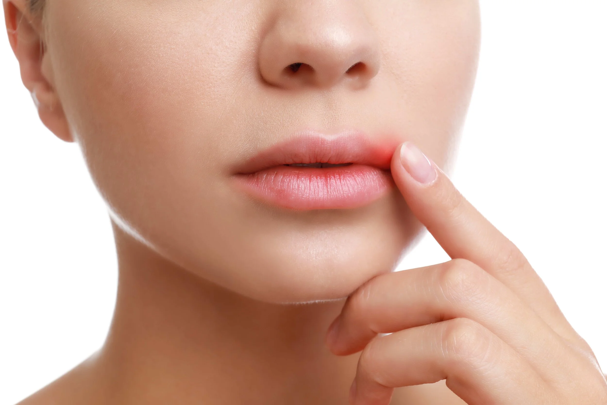 Health Notes: Coping with cold sores