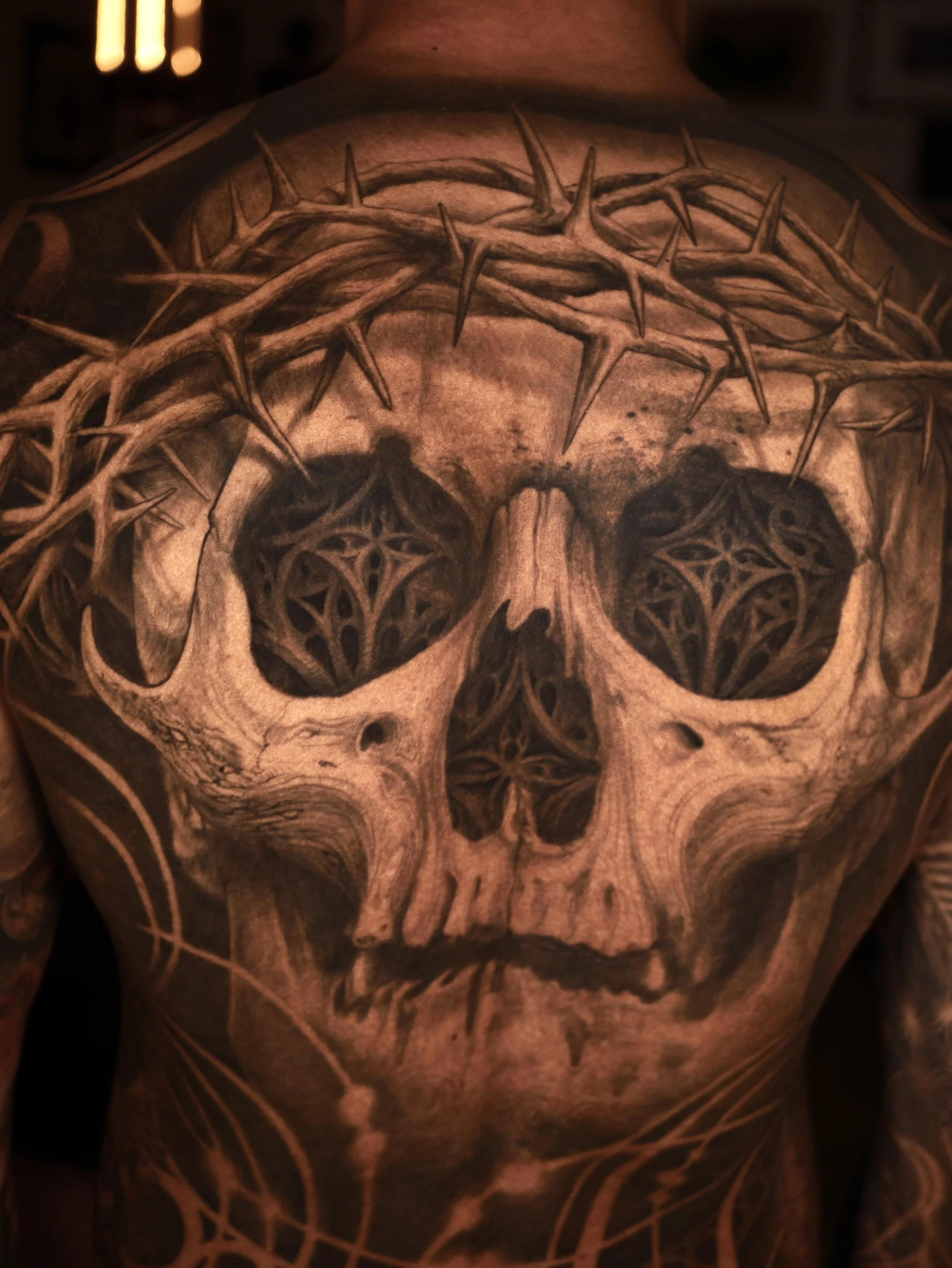 arnold back healed.jpg