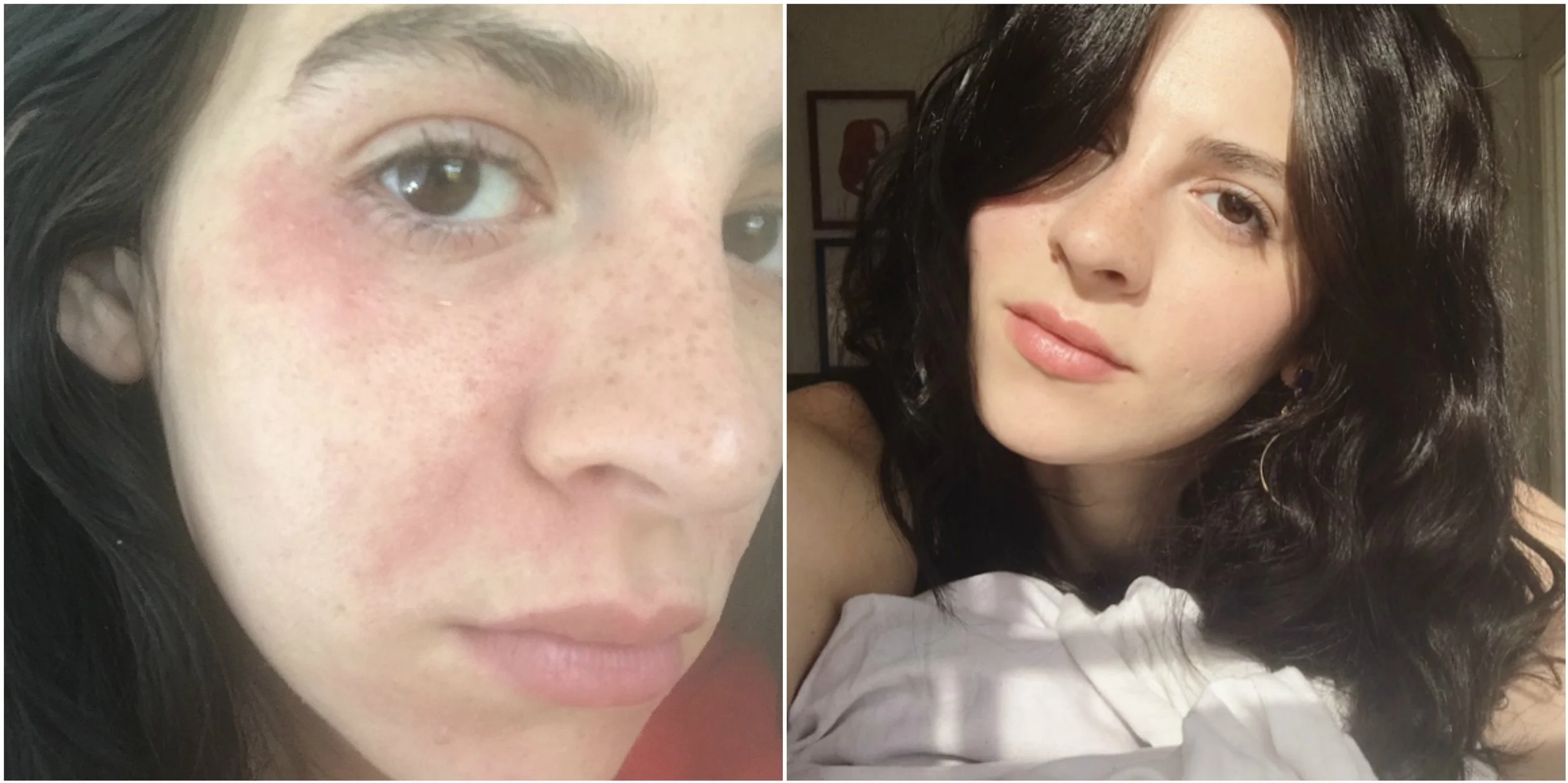 mantra-for-clear-skin.jpg
