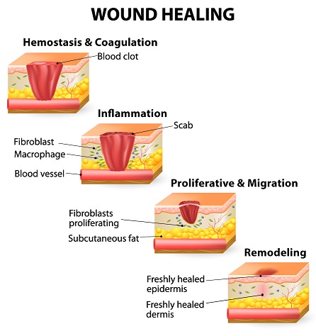 Stages-of-Healing_image.jpg