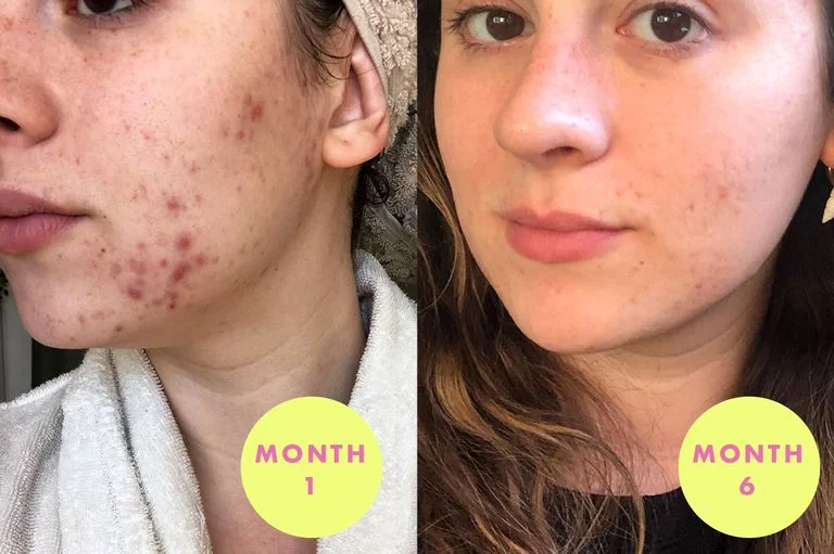 before-after-2-1566914068.jpg
