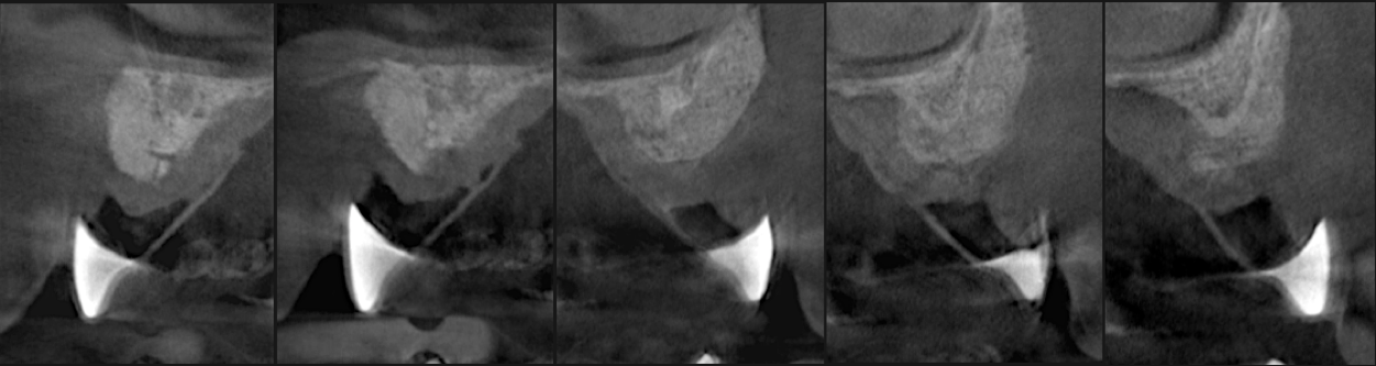 smart-procedure-dentistry.png