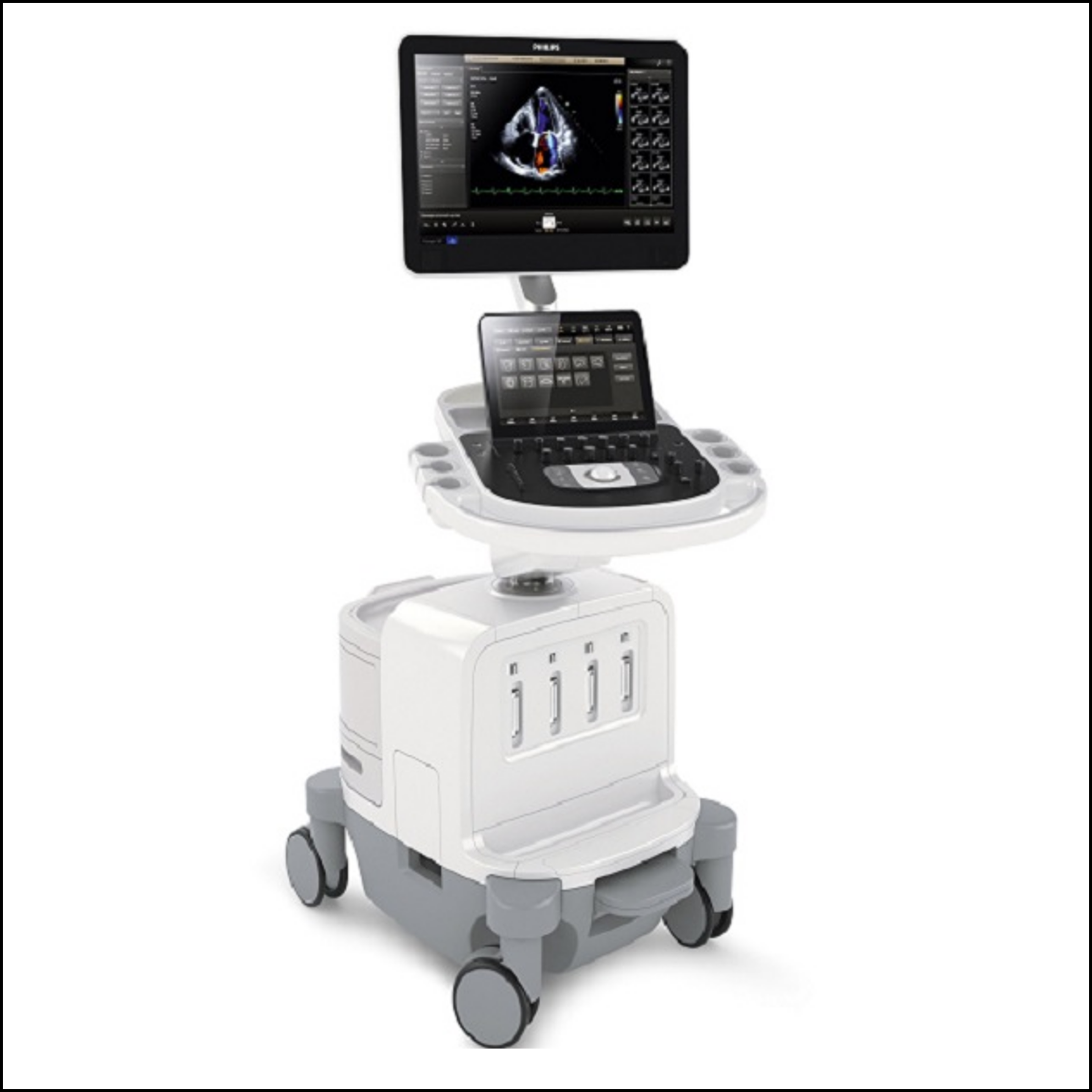 Ultrasound (Epiq 7C, L-12/X-5 transducers; Philips)