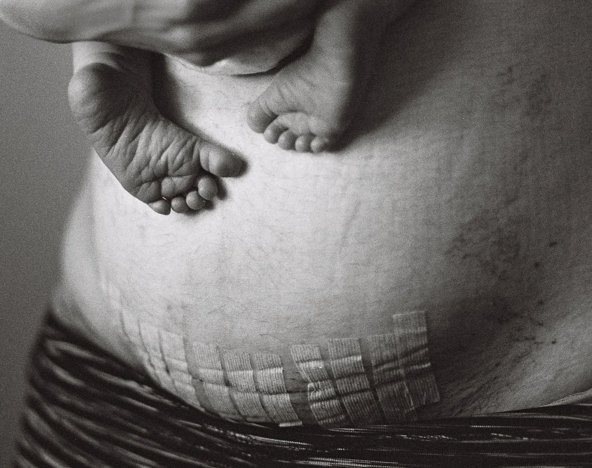 Honoring birth story by documenting the scars.

It&rsquo;s my own deepest honor to preserve your story in co-created pieces of art.