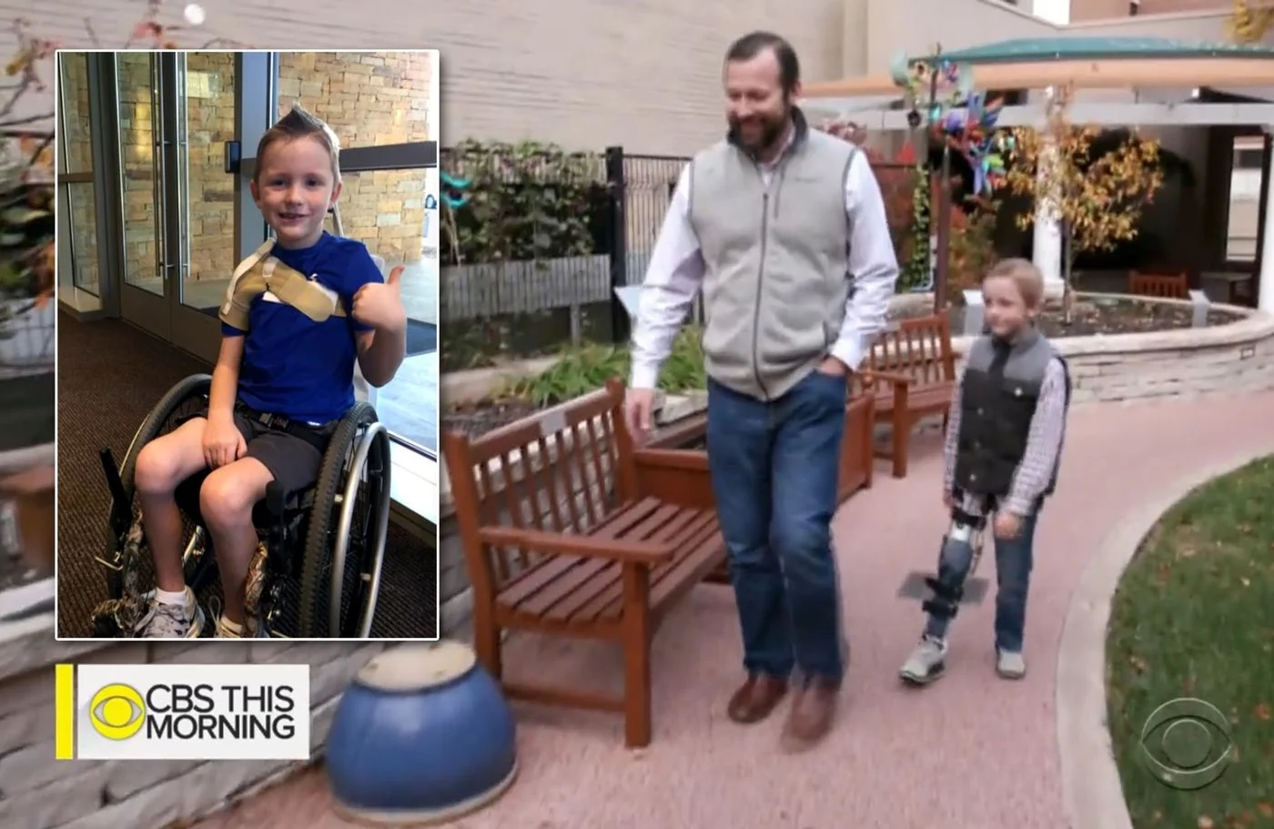 Child Paralyzed From 'Polio-Like' Illness AFM Able to Walk Again After Nerve Transfer Surgery