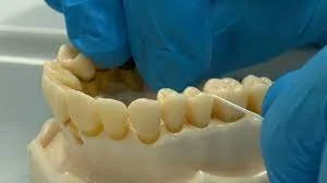World’s 1st Drug to Regrow Teeth Enters Clinical Trials