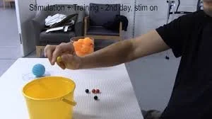 A Device That Zaps the Spinal Cord Gave Paralyzed People Better Control of Their Hands