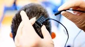 A New, Much More Efficient System Gives Back the Voice to Patients Who Have Lost It