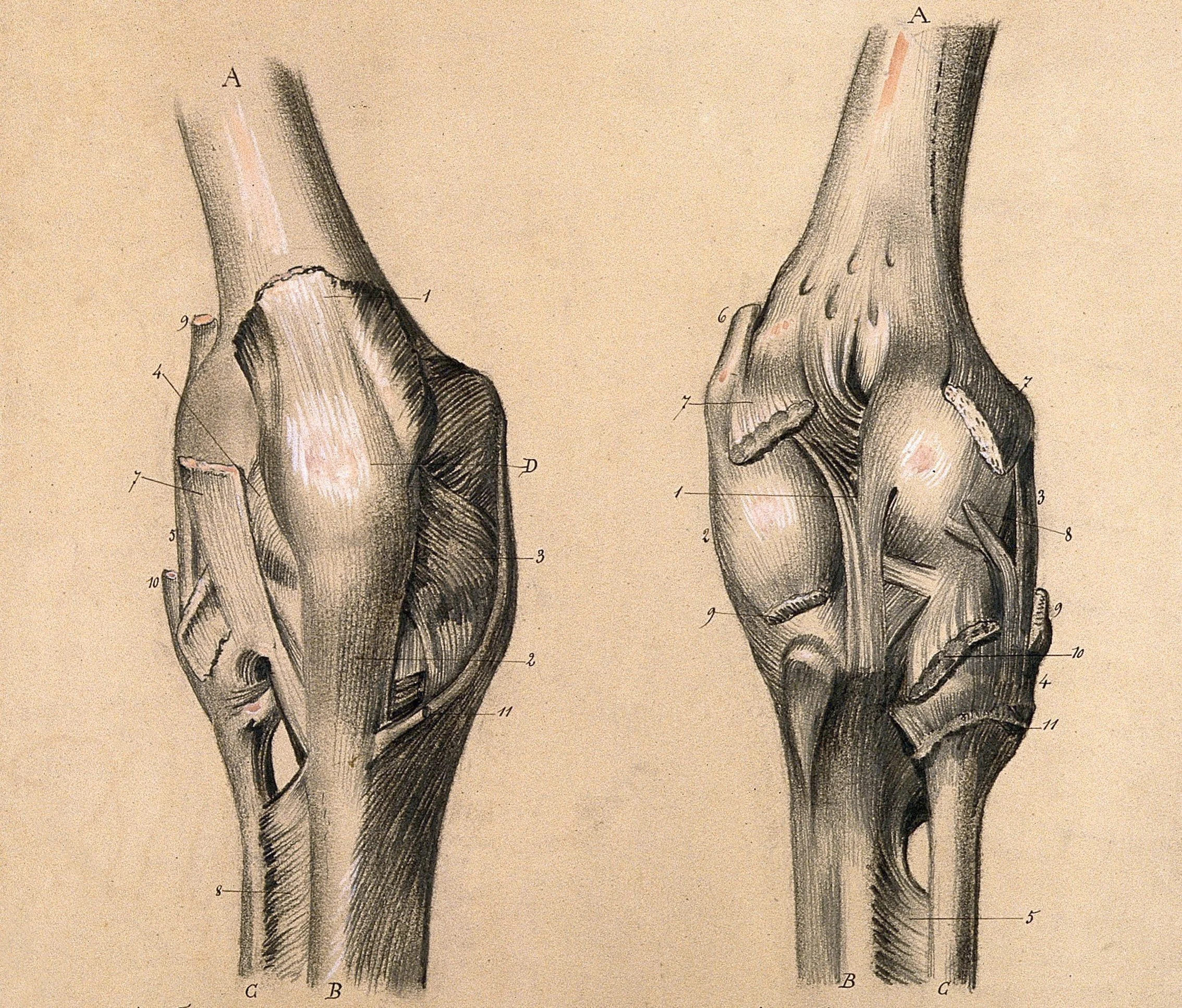 "Sidelined, or No Pain, No Gain" by Mac Crane
