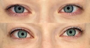 Lash-line enhancement