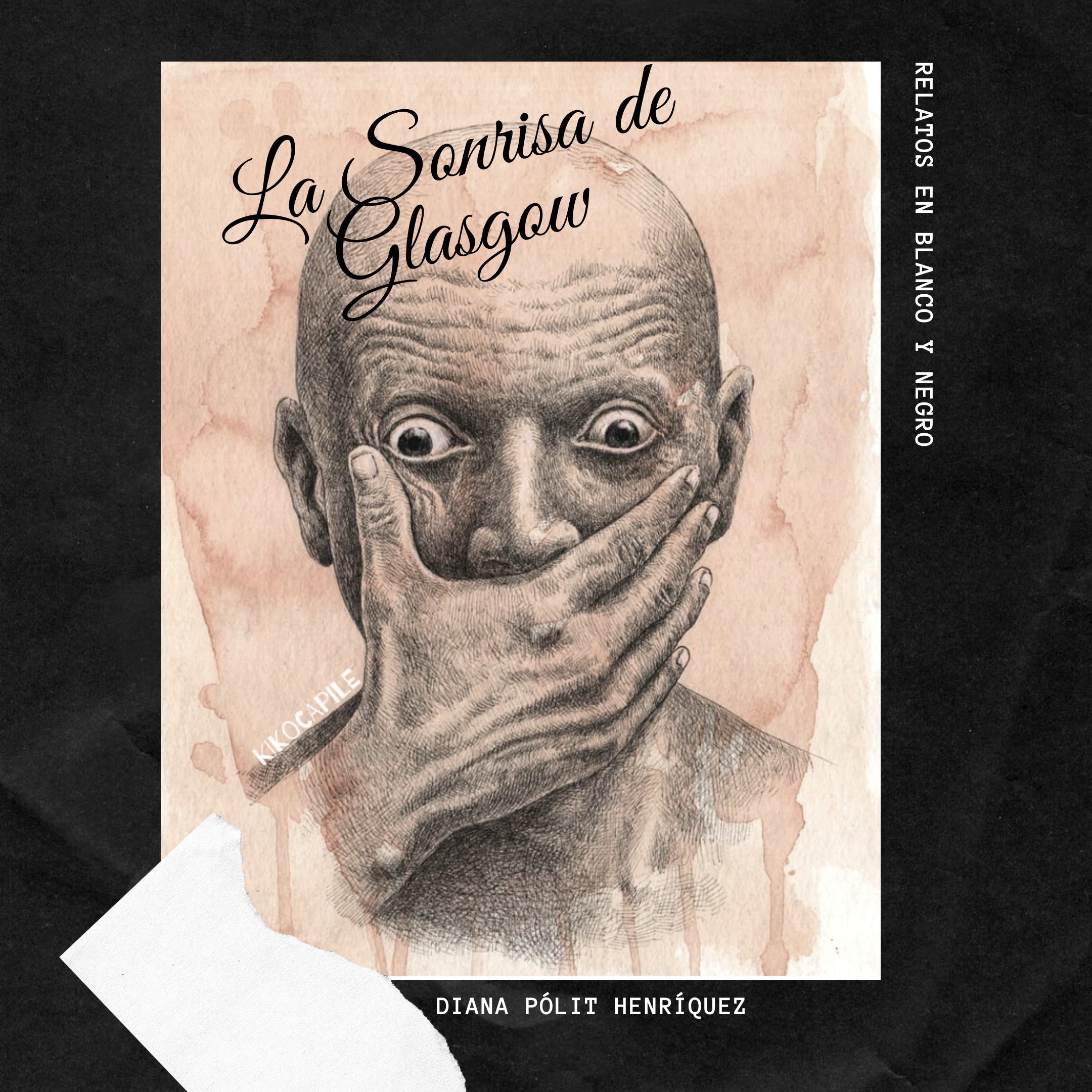La Sonrisa de Glasgow