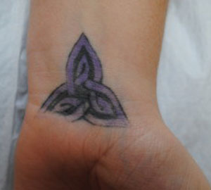 09-Tattoo-Removal-Oregon-Before.jpg