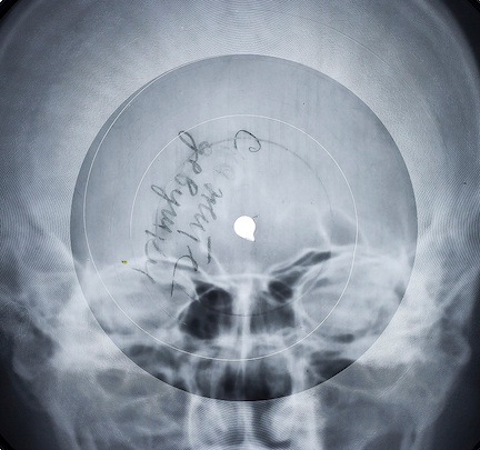 super_collider+-+X-Ray+Audio+1+small.jpg