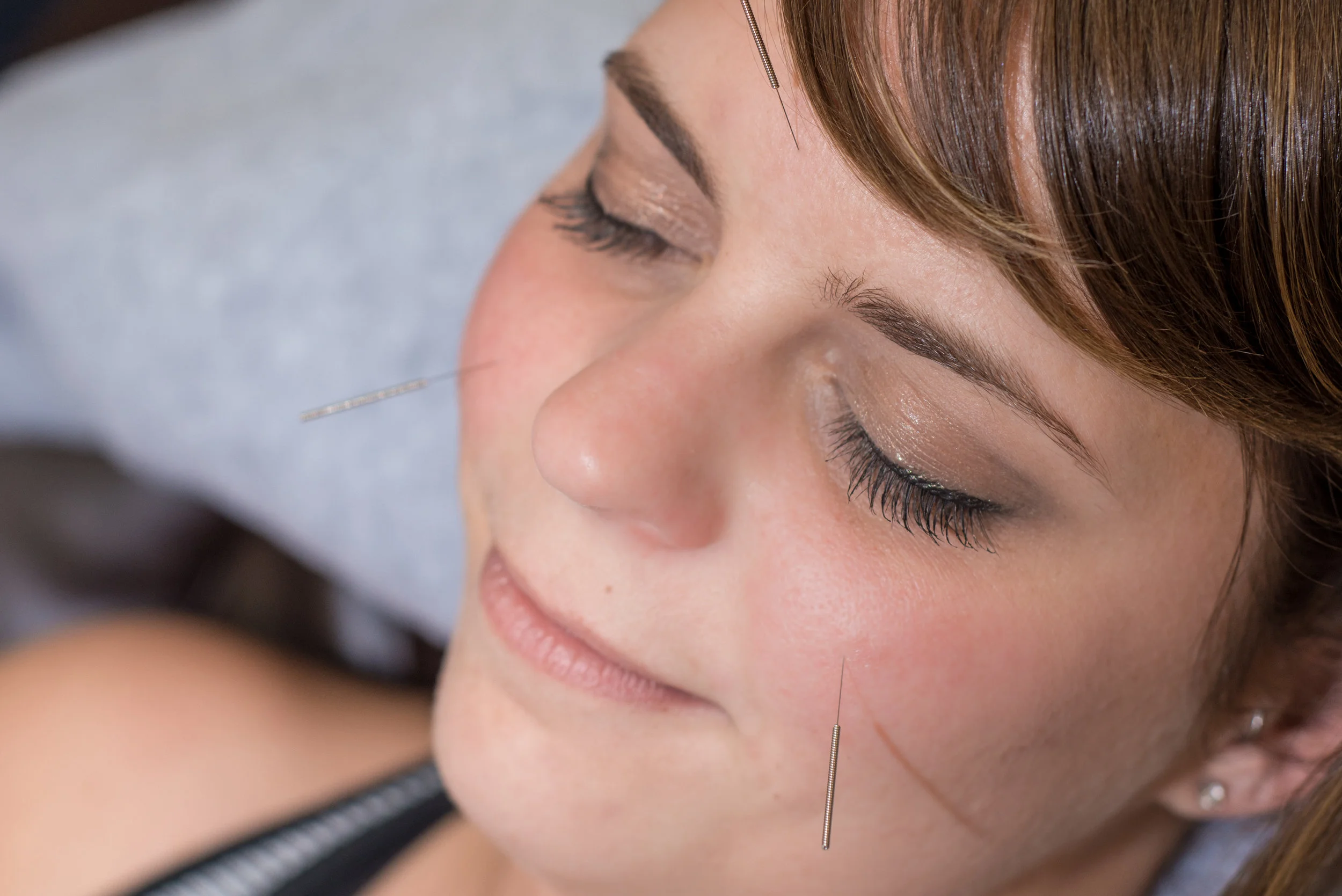 Acupuncture -207.jpg