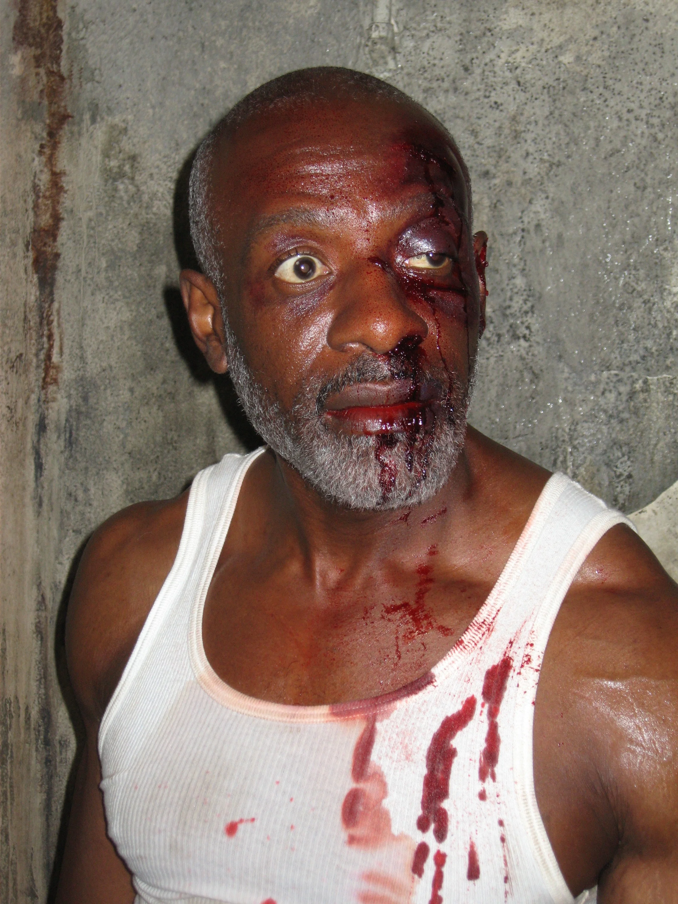 Rothaford Gray- Cell 213- Lip Laceration/Blood/Swollen Eye