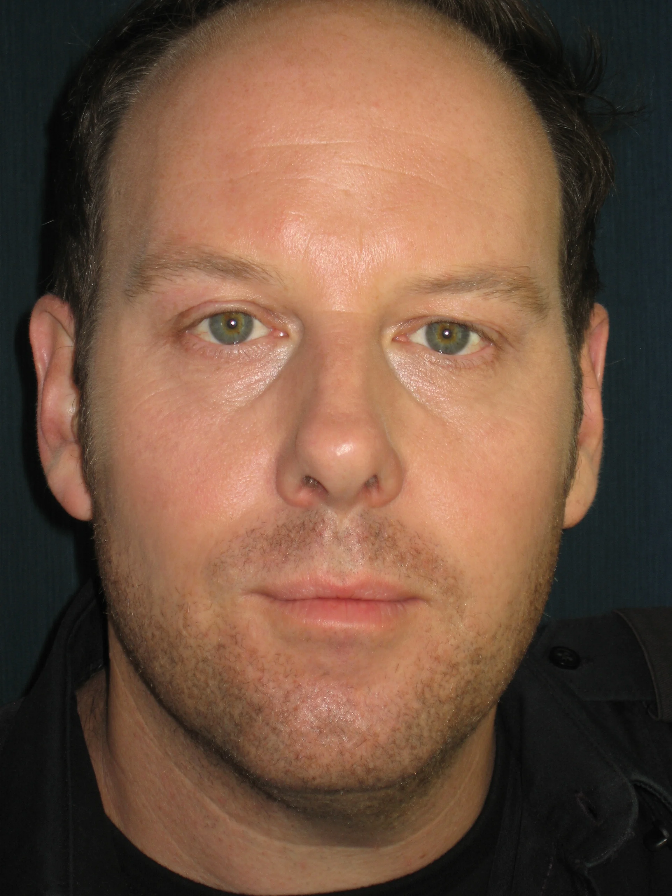 Matt Gordon-Beard Stubble- Rookie Blue