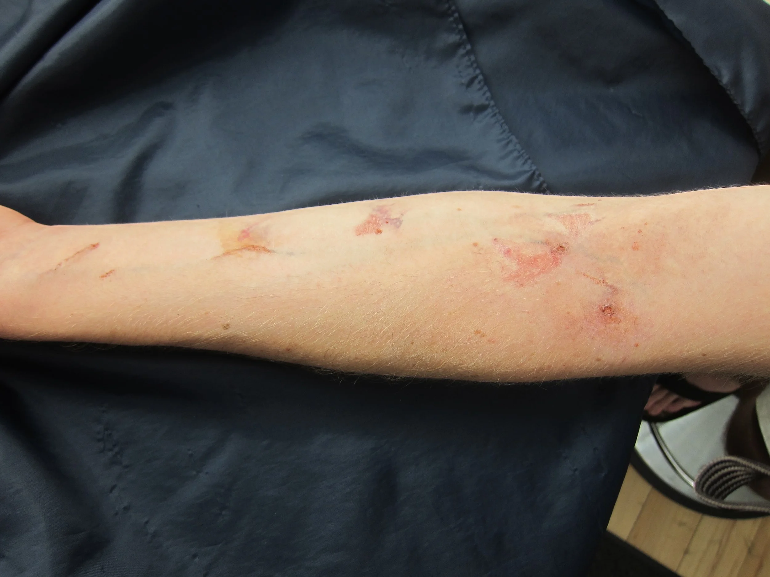 Saving Hope-Heroin Tracks/Contusions