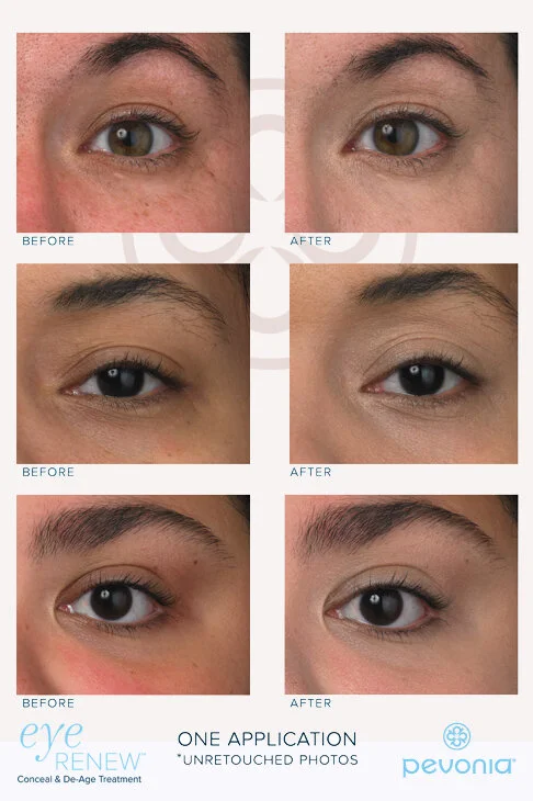 FEE05322-AF9D-4577-87DC-5CE3C1CFF198