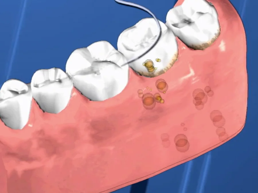 Periodontal Care