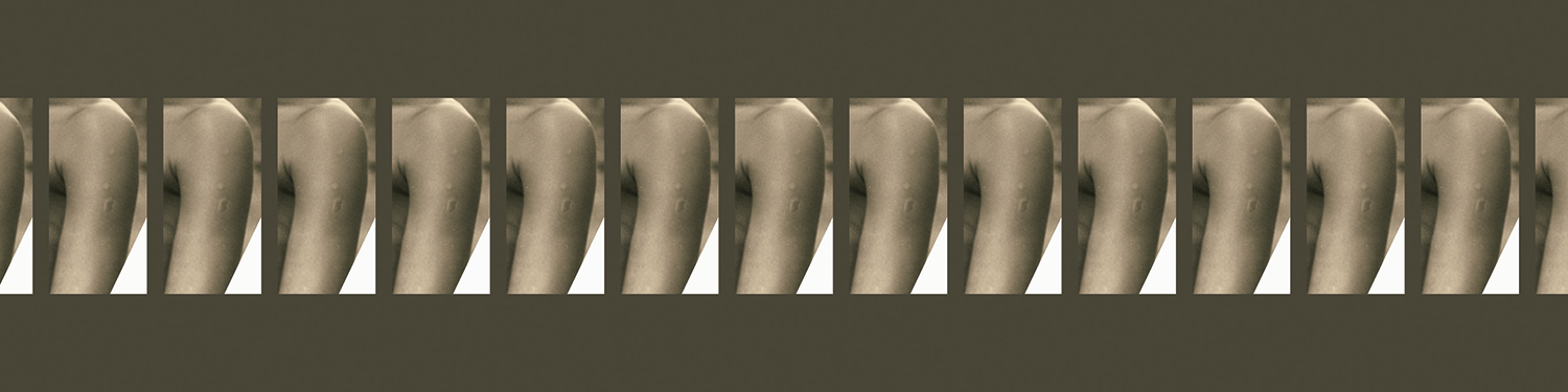 Title: Immunized arm(s) Dimensions: 48 x 12 in