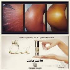 Effective in improving the appearance of stretch marks too,
