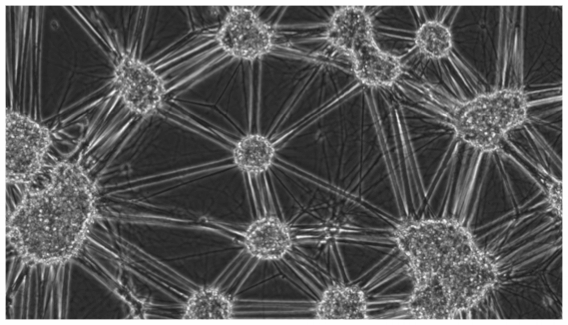 Human motor neurons