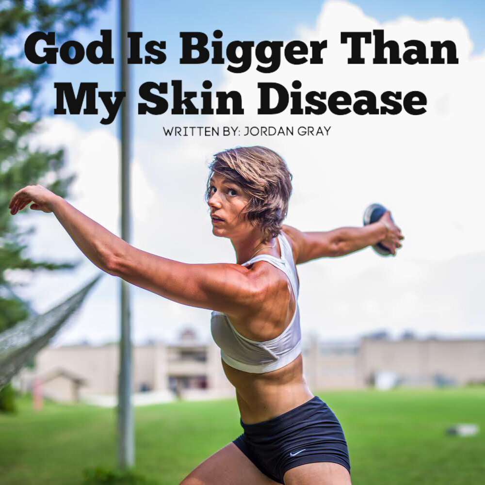 God Is Bigger Than My Skin Disease