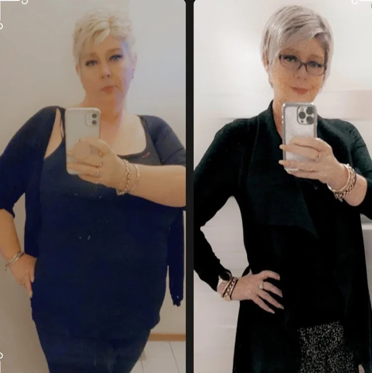 Wendy before and after