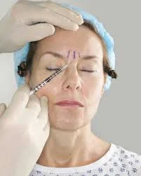 Botox injection