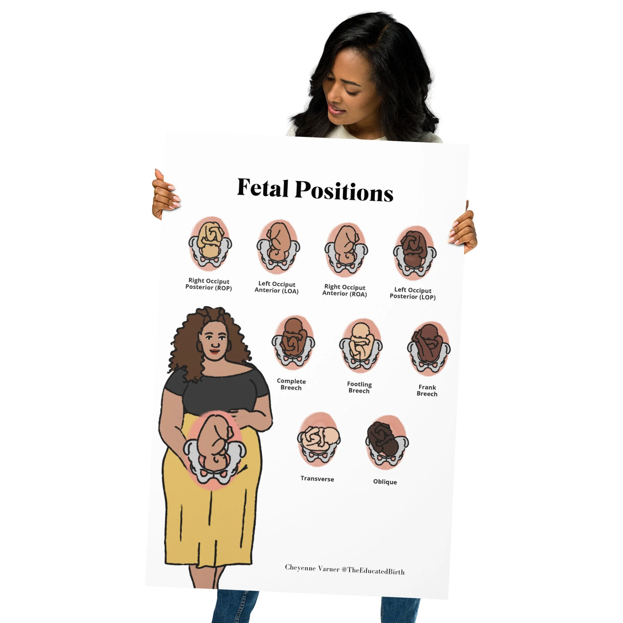 Left Head Position Fetal Head Positions