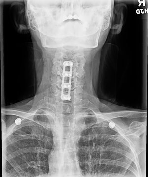 ACDF6b+mustafakhanmd.jpg