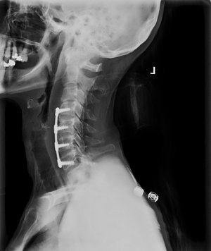 ACDF6c+mustafakhanmd.jpg