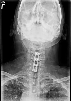 ACDF9b+mustafakhanmd.jpg