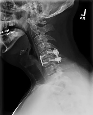 PCF2b+mustafakhanmd.jpg