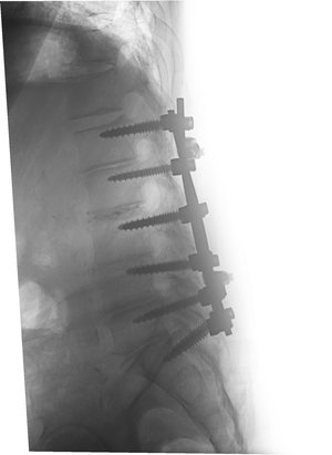 lumbar+20a+mustafakhanmd.jpg