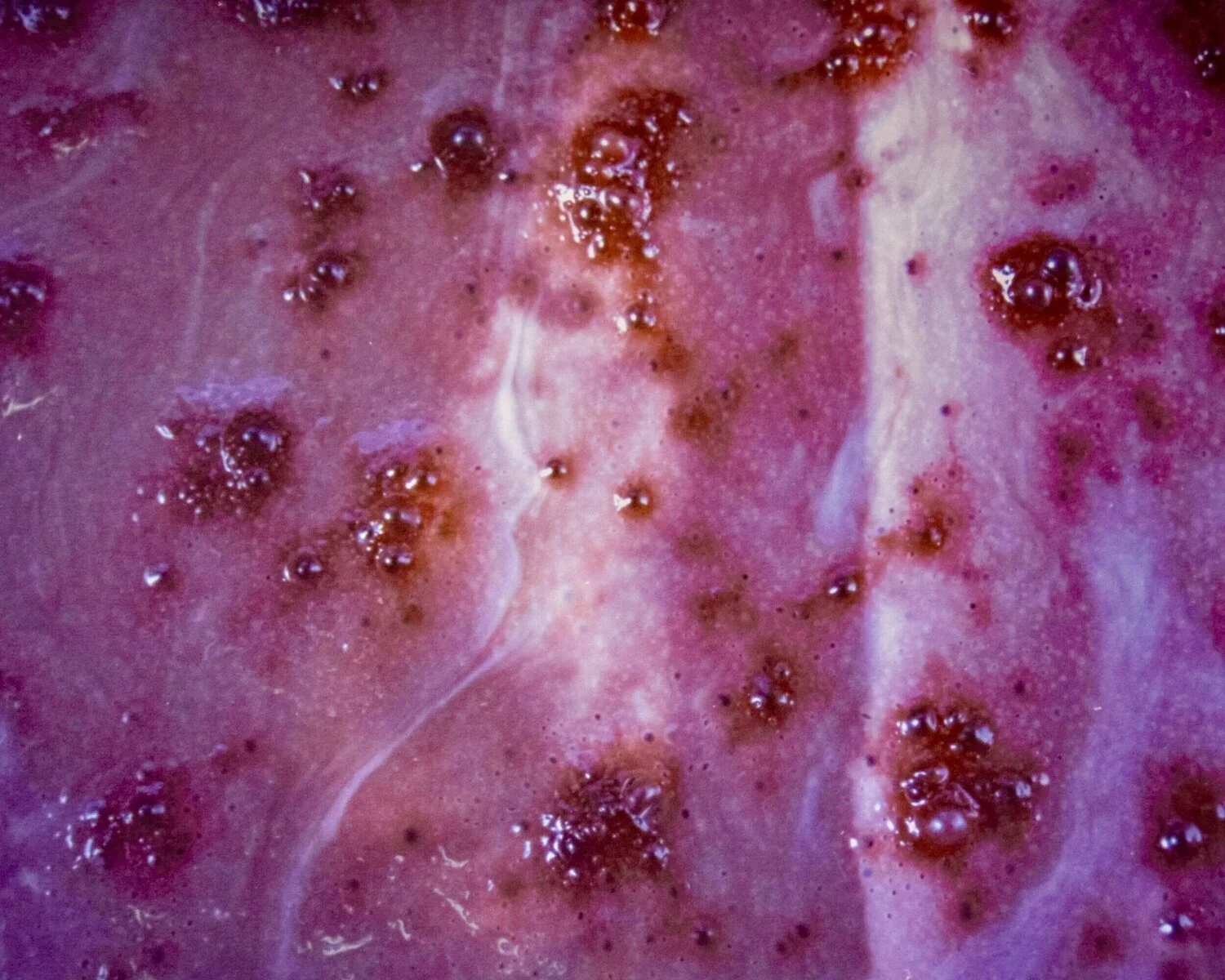 Exposure Therapy: An MFA Exhibit by Samantha Ollstein