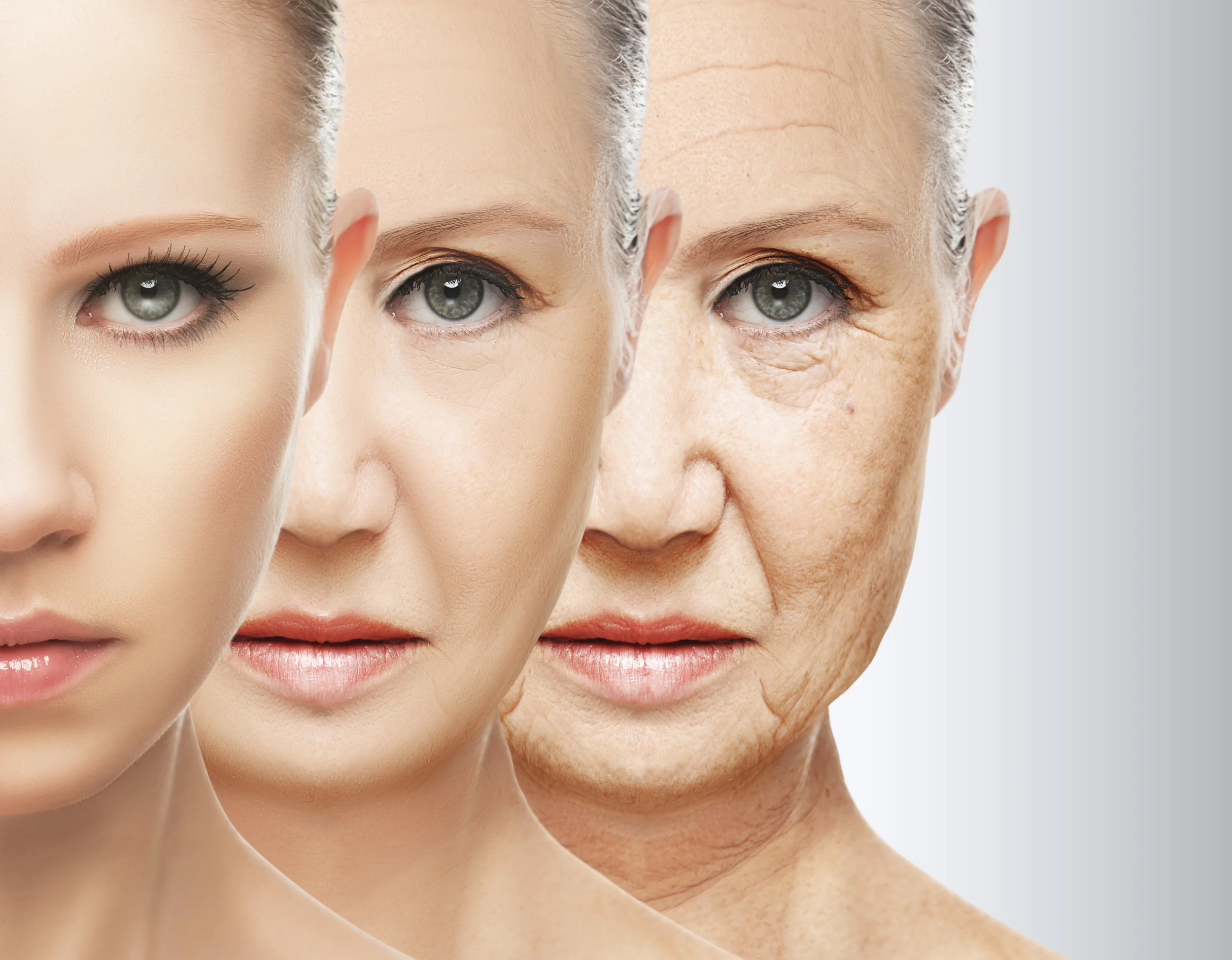 Laser Skin Tightening Before and After